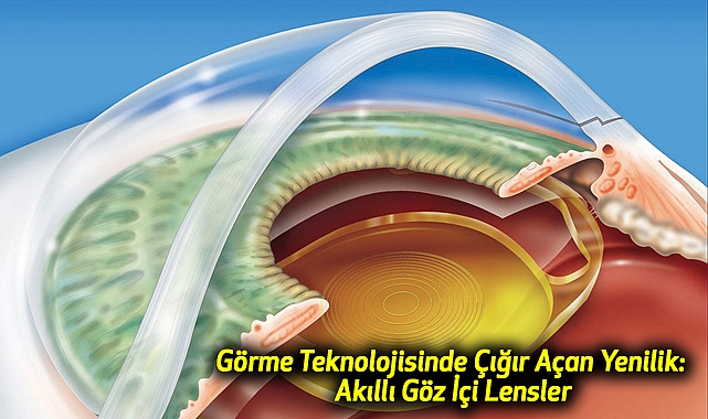 Görme Teknolojisinde Çığır Açan Yenilik: Akıllı Göz İçi Lensler