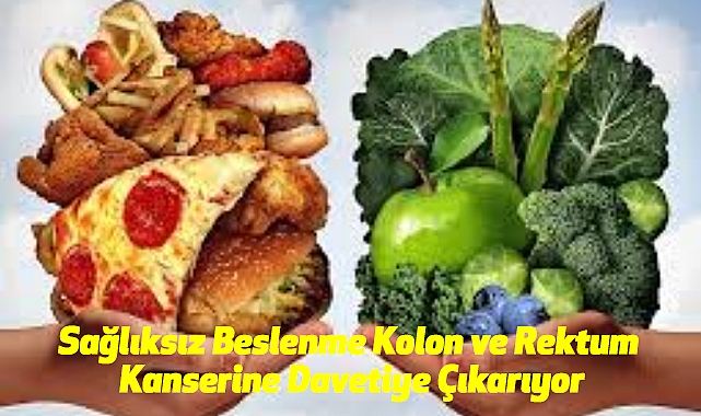 Sağlıksız Beslenme Kolon ve Rektum Kanserine Davetiye Çıkarıyor