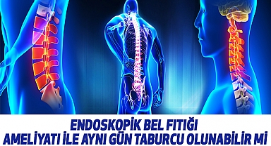 Endoskopik bel fıtığı ameliyatı ile aynı gün taburcu olunabilir mi