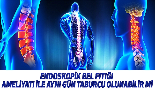 Endoskopik bel fıtığı ameliyatı ile aynı gün taburcu olunabilir mi